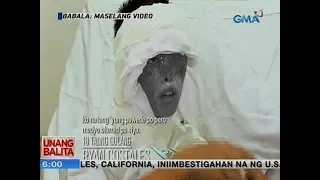 UB: 18-anyos na lalaki, binuhusan ng asido sa mukha ng pinsan dahil umano sa selos