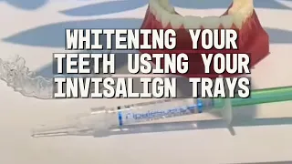 How To Whiten Your Teeth With Your Invisalign Trays