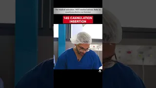 14G Cannulation Insertion | #shorts #ivcannulation #anesthesiology #nurse