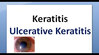 Ophthalmology 110 a Keratitis Cornea Inflammation Corneal Ulcer Ulcerative Ulceration