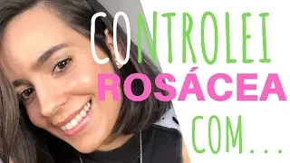 ROSÁCEA NO CONTROLE!!! [DIÁRIO DA PELE - PARTE IV] | Iruama
