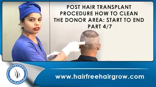 Post Hair Transplant Procedure: Start to End - part 4/7 cleaning day | How To Clean The Donor Area