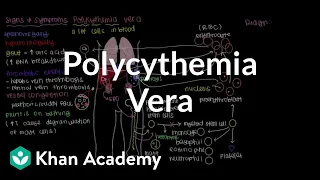 What is polycythemia vera? | Hematologic System Diseases | NCLEX-RN | Khan Academy