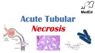 Acute Tubular Necrosis (ATN) | Symptoms, Causes and Treatments