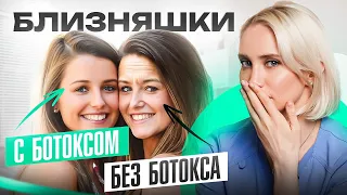 Ботокс в 2024. Колоть или не колоть? (что делать если не встал)