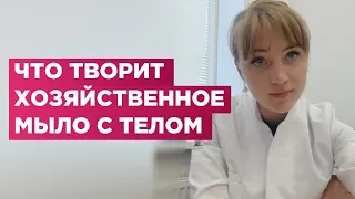 Хозяйственное мыло как дешевое лекарство от прыщей и молочницы.Можно ли им пользоваться