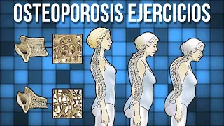 🦴 Rutina de EJERCICIOS para la OSTEOPOROSIS
