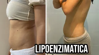 FIZ MINHA LIPOENZIMATICA E AMEI O RESULTADO! *2 sessões*