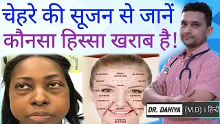 क्यों होती है चेहरे पर सूजन || WHY YOUR FACE LOOKS SWOLLEN | Chehre ki sujan ko kaise dur karen