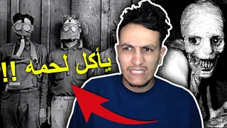 أرادوا تطوير الإنسان إلى مخلوق خارق فأصبح وحش !!💀😵 ( حكاية )