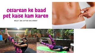 Cesarean ke baad pet kaise kam karen| How to Reduce Belly Fat Post C- Section | Hindi | Workout Flow