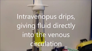 Applied Pharmacology 9, Rate of intravenous drips