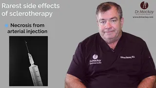 What are the Side Effects of Sclerotherapy? Q&A with Dr. Edward Mackay