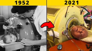 The Man In The Iron Lung |  Man Locked In This Machine For Almost 70 Years