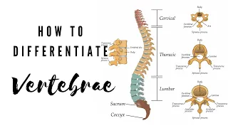 How to differentiate Vertebrae | Viva Voce of Anatomy