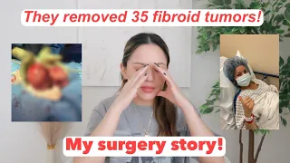 My Crazy Uterine Fibroid Surgery | Story Time | Massive Fibroid Tumors Journey | Myomectomy |Post-op