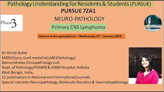 Pursue 7 Z A1 :Primary CNS Lymphoma