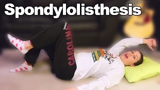 Spondylolisthesis Exercises & Stretches for Back Pain - Ask Doctor Jo