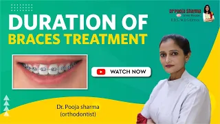 How Much Duration For Braces Treatment | Complete Treatment In Agra |Orthodontist | Dr Pooja Sharma