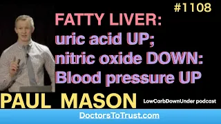 PAUL MASON b: |  FATTY LIVER: uric acid UP; nitric oxide DOWN: Blood pressure UP