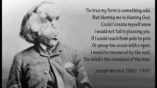 The Tragic Story of Joseph Merrick | The Elephant Man