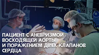 Аневризма восходящей аорты с поражением двух клапанов сердца