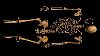 Is the Skeleton Found in Leicester Richard III?