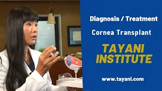 Cornea Transplant - PK, DMEK, DSAEK | Tayani Institute