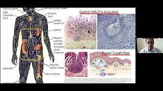 ISG MASTERCLASS (25):  Gastrointestinal Lymphoma