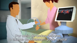 Artrite reumatoide: entenda por que o médico indica o exame de ultrassom