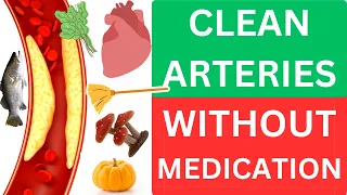 Top 10 Foods to Unclog Arteries Naturally and Prevent Heart Attack!