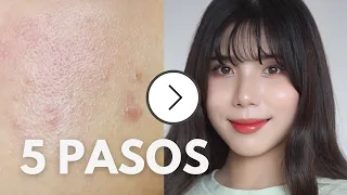 CÓMO ELIMINAR EL ACNÉ EN 5 PASOS I Tips del Skincare Coreano✨