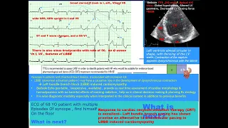 2 Test your skill  ECG ECHO case study