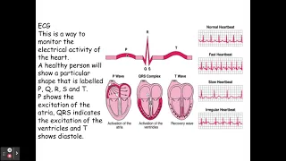 3.1.2. Transport in Animals h) The use and interpretation of electrocardiogram (ECG) traces