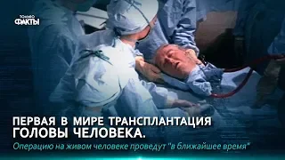 ПЕРВАЯ В МИРЕ ТРАНСПЛАНТАЦИЯ ГОЛОВЫ ЧЕЛОВЕКА...