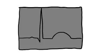 Po mojemu: EKG cz. 5