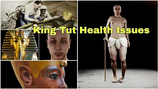 Tutankhamun Health Issues