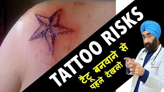 TATTOO ke Dangerous Side effects | टैटू के साइड इफेक्ट्स | Dr.Education