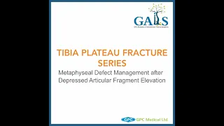 Tibia Plateau Fracture Series | GAITS Academy | GPC Medical Ltd.