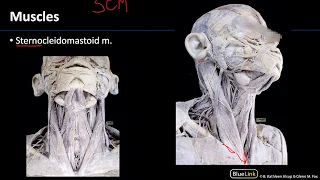 Anterior Neck - Muscles