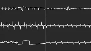 COMMODORE C64 SID 2023 - R TYPE AMIGA 2 SID - JASON PAGE - 6 CHANNEL MONO TUNE / Oscilloscope View