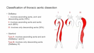 Anesthesia Considerations for TAA Dissection  - Dr. Klimkina