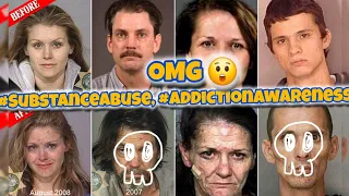 What Happens To Your Body If You Do Meth and Other Drugs part 2 #SubstanceAbuse, #AddictionAwareness