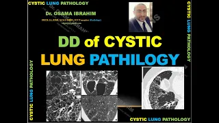 How to pick up easily FINAL DIAGNOSIS of Cystic Lung pathology (DD)