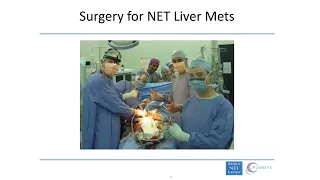 Neuroendocrine Cancer Liver Metastasis & Surgery for Neuroendocrine Tumours