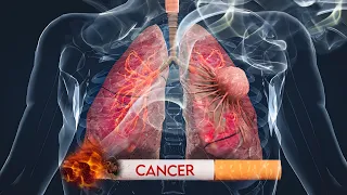 How Cancer Starts ?  : 3D Animation