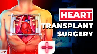 Heart Transplant Surgery: Everything You Need To Know
