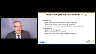 Cutaneous Squamous Cell Carcinoma - Updates in Immunotherapy presented by Dr. Butler MD