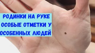 Родинки на руке (на холмах и линиях)/Хиромантия/коррекционная хиромантия