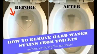 How to Remove Hard Water Stains from Toilets (WITHOUT scratching the porcelain!!!)